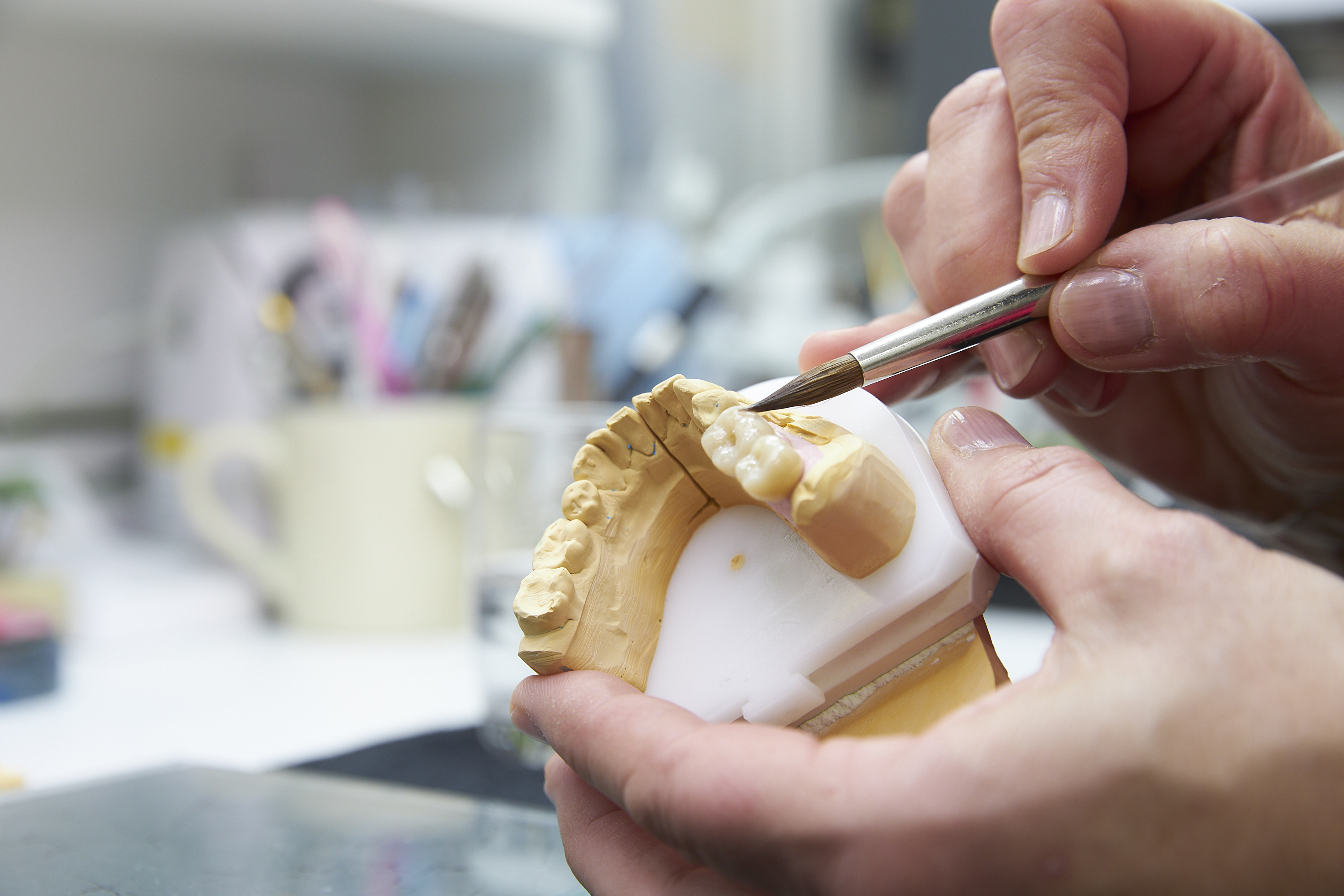 Zahntechnische Handarbeit an einem Zahnmodell